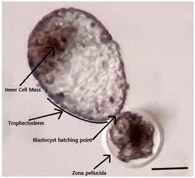 Case report: Spontaneous abortion of monoamniotic twins at the third trimester of pregnancy in Camelus dromedarius